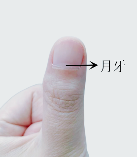 指甲出現(xiàn)一條黑線 別不當回事！可能是癌變