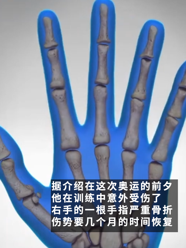 絕對(duì)狠人！為了參加奧運(yùn)會(huì)：一老哥把手指切了
