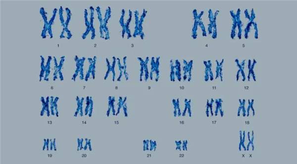 6號(hào)染色體缺失 英國(guó)女孩無(wú)痛覺(jué)、無(wú)饑餓、無(wú)疲勞：全球唯一