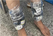 女子小腿綁40塊卡西歐手表進(jìn)境 結(jié)果因步態(tài)僵硬被查獲