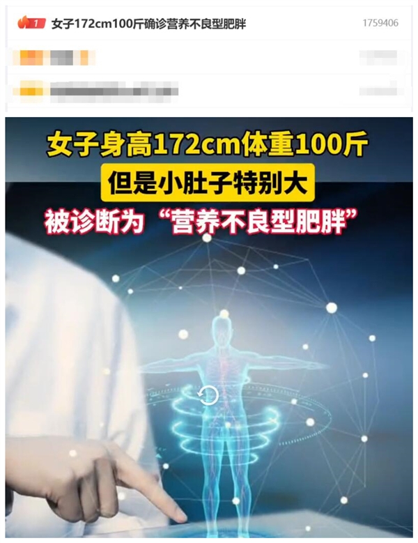 熱搜第一！女子172cm100斤確診營養(yǎng)不良型肥胖