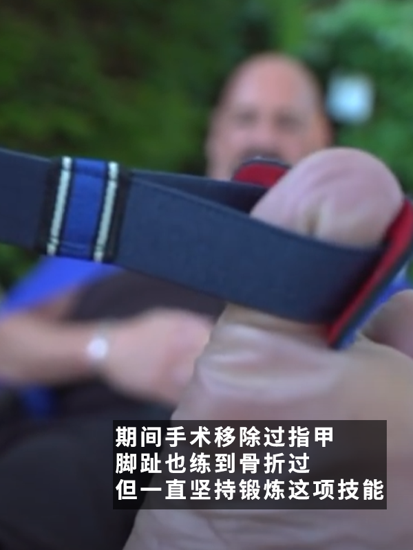 聽著就很有味道的比賽：腳趾毀滅者拿下“掰腳趾大賽”冠軍！