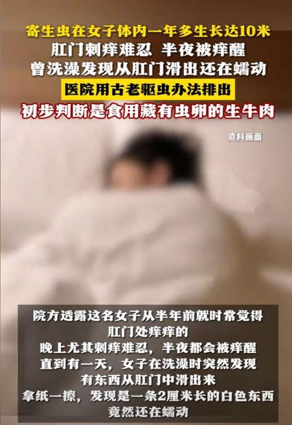 女子體內(nèi)排出10米長(zhǎng)寄生蟲：或與食用生牛肉有關(guān)
