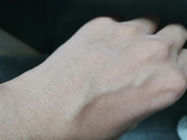 為什么有的人手上青筋暴起 這些地方出現(xiàn)青筋：一定要小心