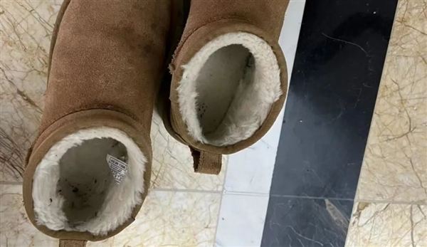 雪地靴又上熱搜！經(jīng)常穿真的很傷腳 醫(yī)生緊急提醒