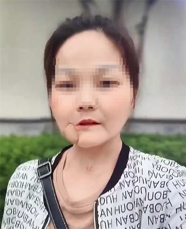 嚼檳榔10年患口腔癌的博主離世：一級致癌物、不吃為妙