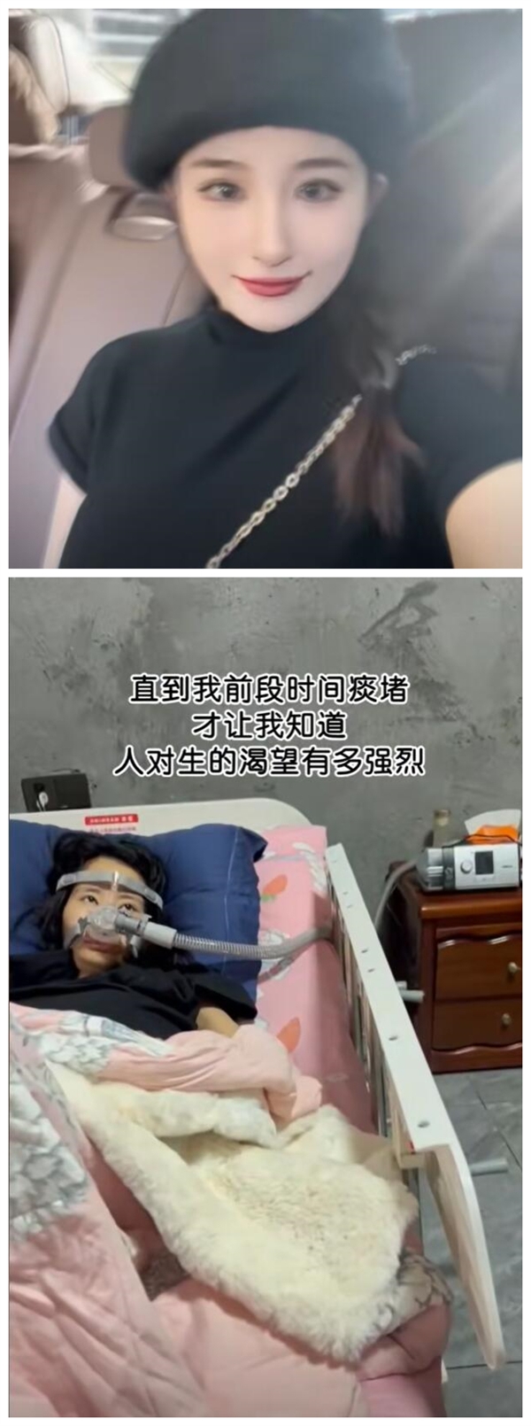 女生確診漸凍癥容貌巨變 母親回應(yīng)：剛從ICU出來 一清醒就想做視頻