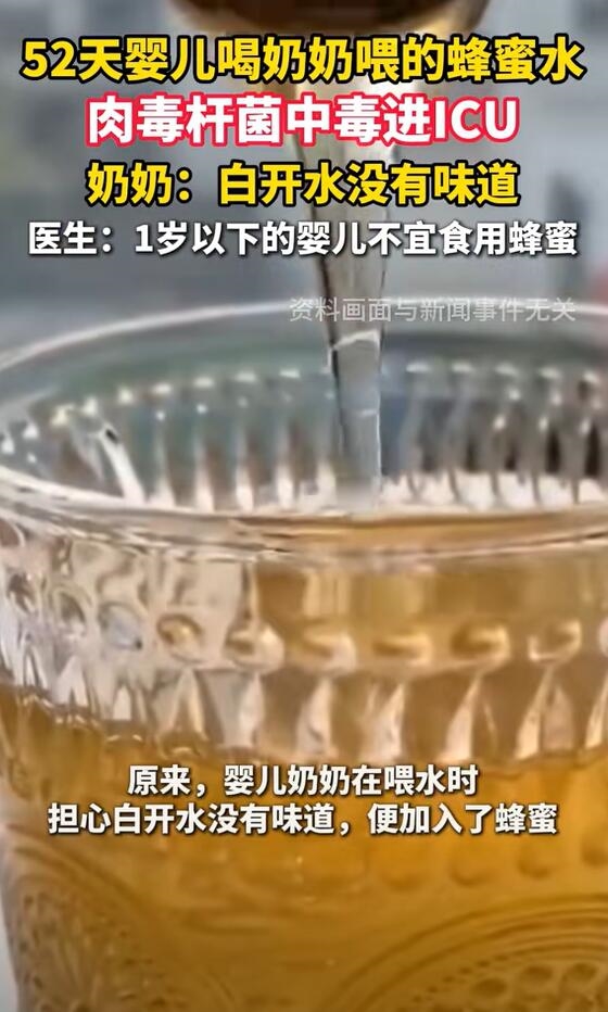 52天嬰兒喝奶奶喂的蜂蜜水中毒進(jìn)ICU 醫(yī)生：蜂蜜不適合嬰兒