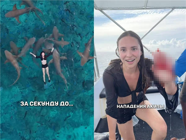 俄羅斯女歌手與鯊魚共游被咬傷：嚇到崩潰大哭