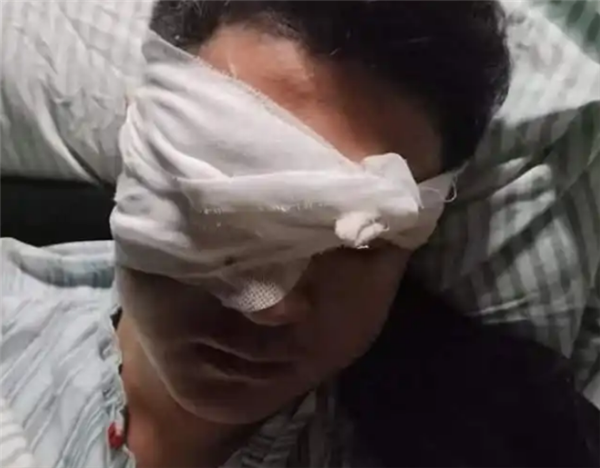 男子除夕夜遭煙花炸傷眼球被摘除：肇事者沒(méi)找到