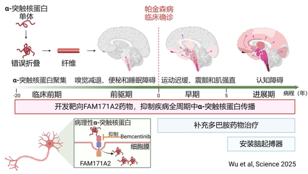 全球首次！復(fù)旦團隊發(fā)現(xiàn)帕金森全新治療靶點：AI大顯身手