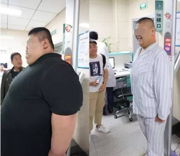 國家“體重管理年”行動下，山東三甲醫(yī)院減重門診成效顯著 國家行動激發(fā)，山東三甲醫(yī)院減重門診火爆來襲